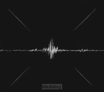 We Will Not Be Shaken Deluxe Finale Uitverkoop